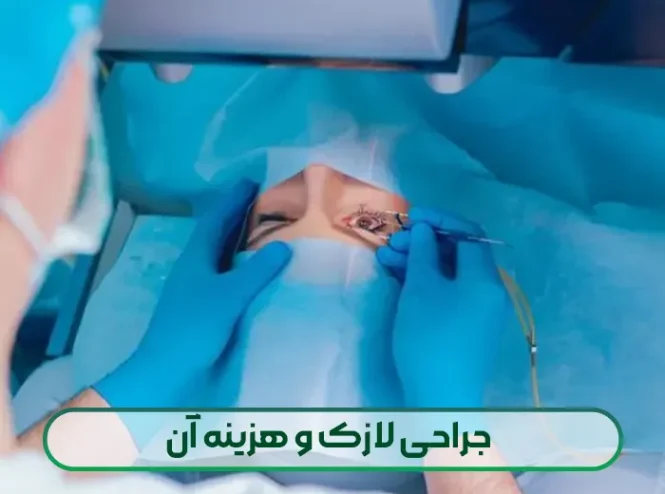 جراحی لازک و هزینه آن
