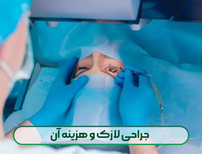 جراحی لازک و هزینه آن