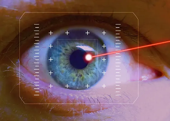 لیزیک برای آستیگماتیسم