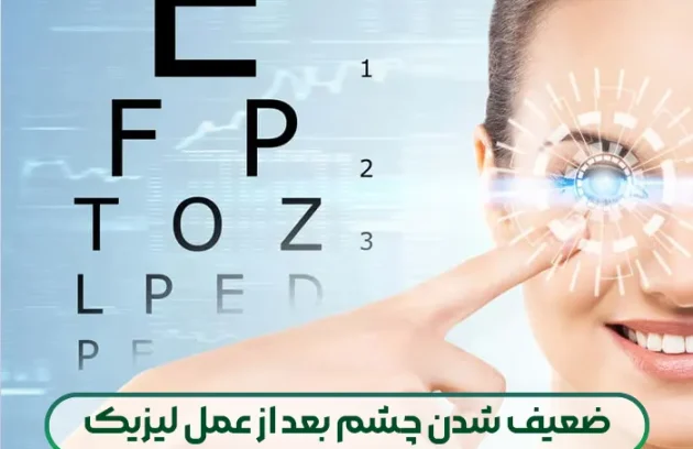 ضعیف شدن چشم بعد از عمل لیزیک
