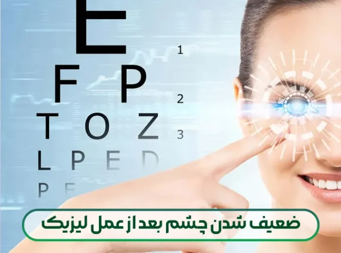 ضعیف شدن چشم بعد از عمل لیزیک