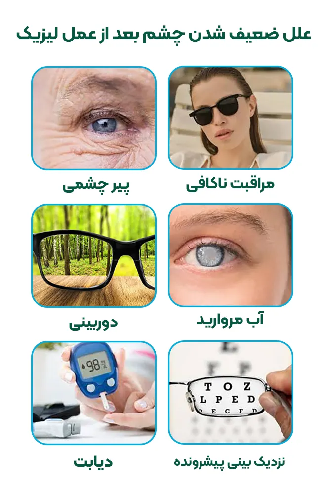 علل ضعیف شدن چشم بعد از عمل لیزیک