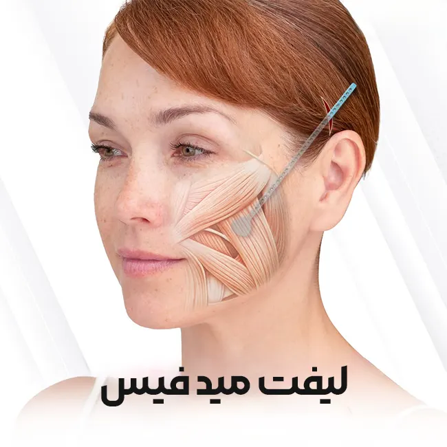 جراحی لیفت میدفیس