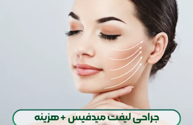 جراحی لیفت میدفیس