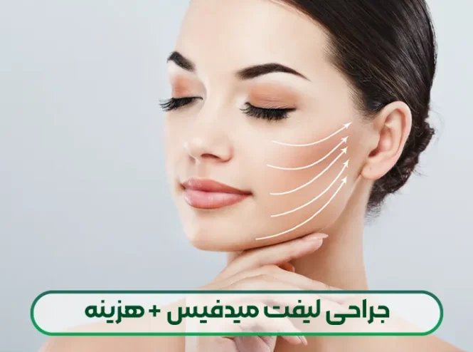 جراحی لیفت میدفیس
