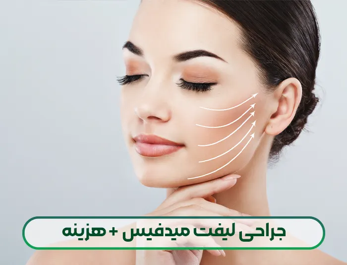 جراحی لیفت میدفیس