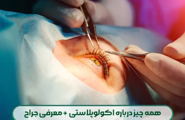 همه چیز درباره اکولوپلاستی