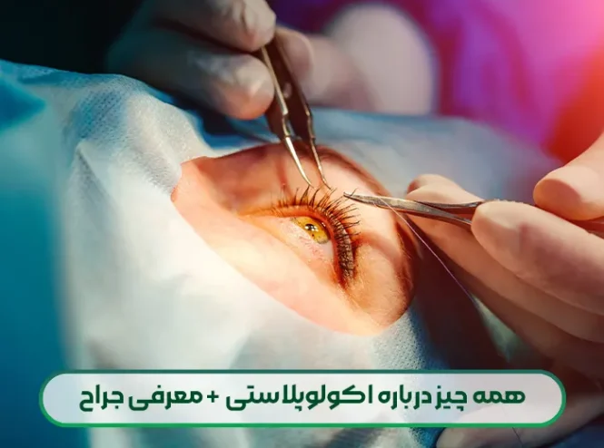 همه چیز درباره اکولوپلاستی