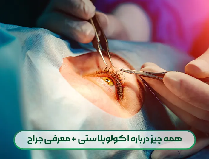 همه چیز درباره اکولوپلاستی