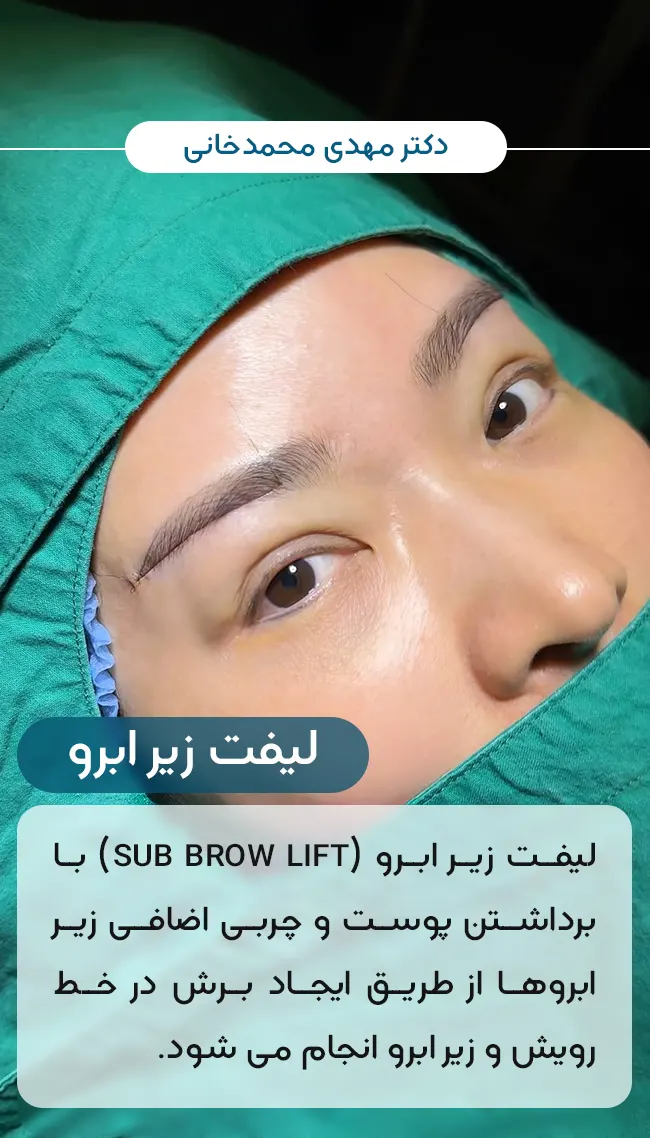 هزینه جراحی لیفت زیر