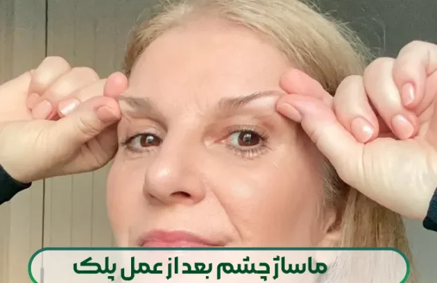 ماساژ چشم بعد از عمل پلک