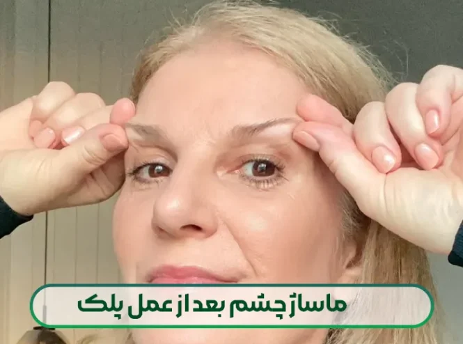 ماساژ چشم بعد از عمل پلک