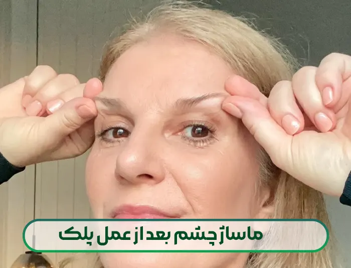 ماساژ چشم بعد از عمل پلک