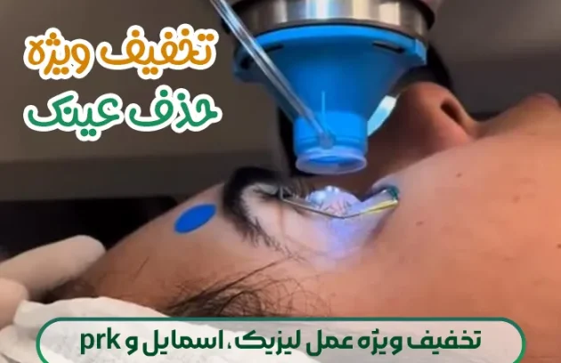 تخفیف ویژه عمل لیزیک، اسمایل و prk