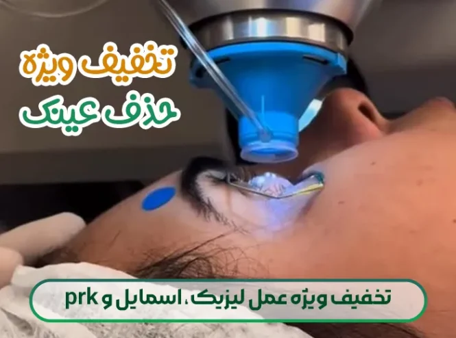 تخفیف ویژه عمل لیزیک، اسمایل و prk