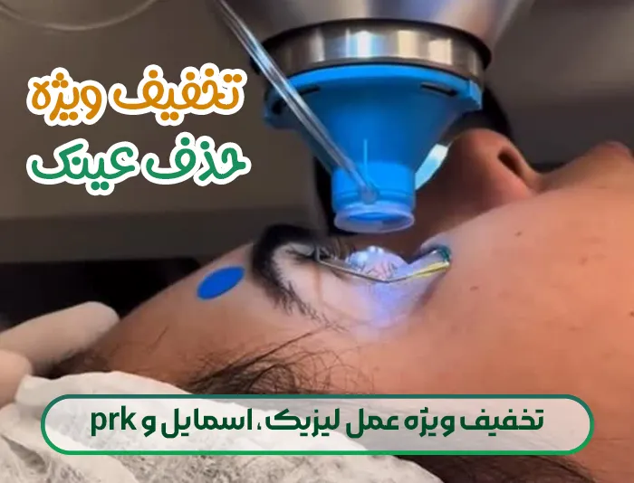 تخفیف ویژه عمل لیزیک، اسمایل و prk