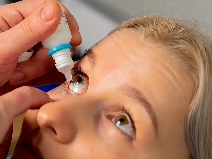 مراقبت های بعد عمل لیزیک چشم کودک