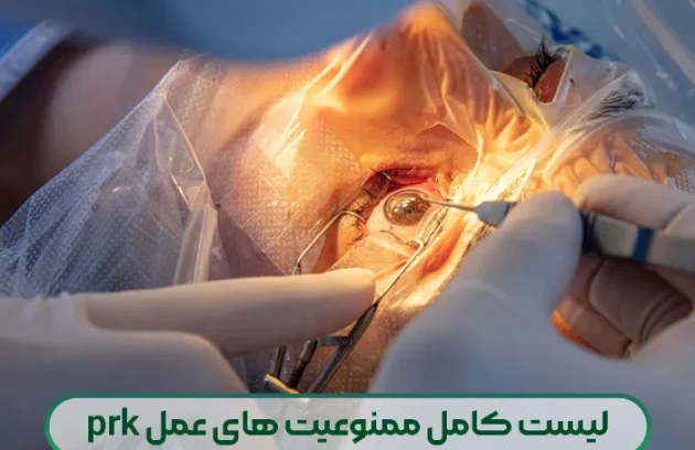 لیست کامل ممنوعیت های عمل prk