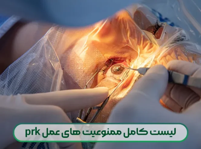 لیست کامل ممنوعیت های عمل prk
