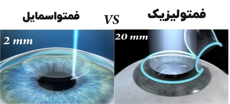 مقایسه فمتولیزیک و فمتو اسمایل