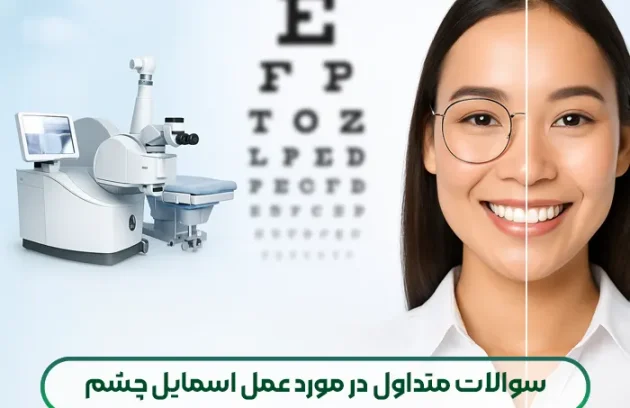 سوالات متداول در مورد عمل اسمایل چشم