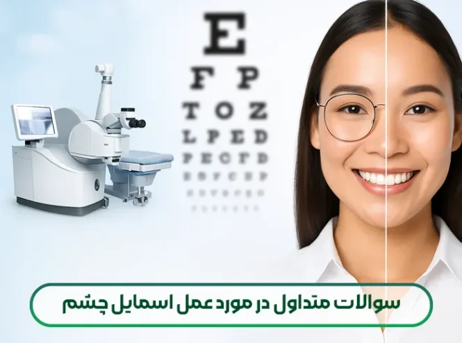 سوالات متداول در مورد عمل اسمایل چشم