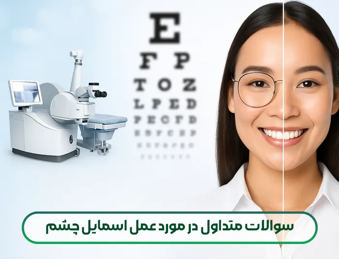 سوالات متداول در مورد عمل اسمایل چشم