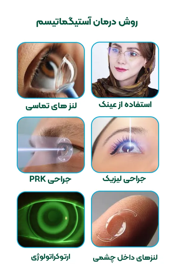روش درمان آستیگماتیسم
