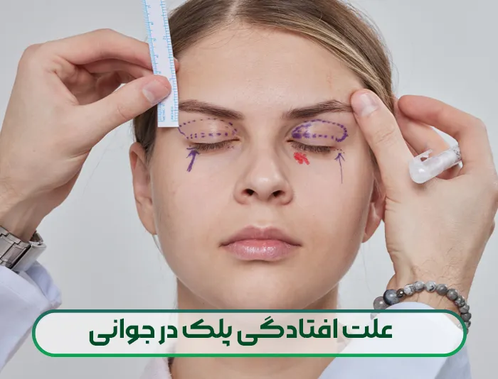 علت افتادگی پلک در جوانی