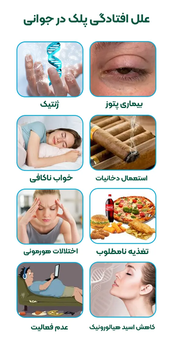 علل افتادگی پلک در جوانی