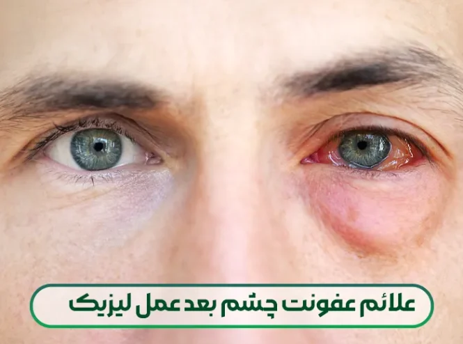 عفونت چشم بعد عمل لیزیک