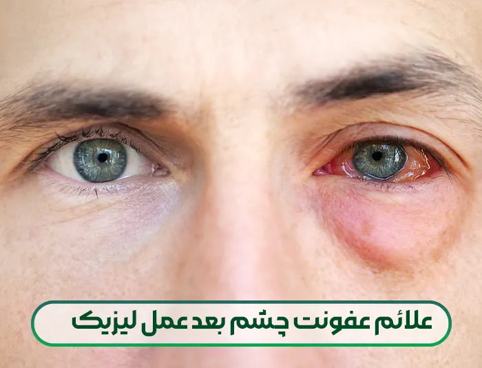 عفونت چشم بعد عمل لیزیک