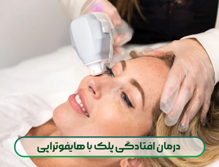 درمان افتادگی پلک با هایفوتراپی