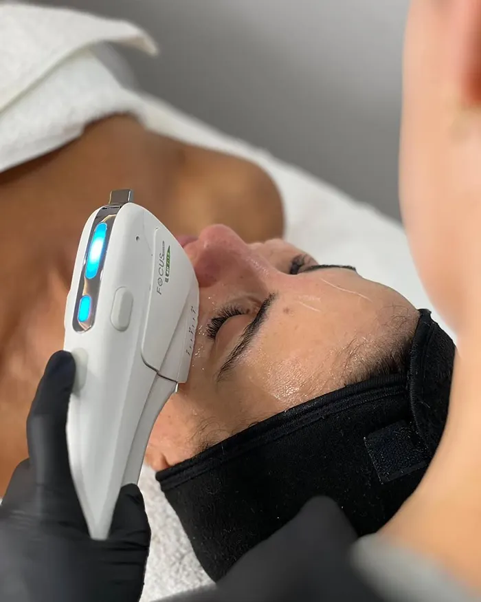 درمان افتادگی پلک با هایفوتراپی