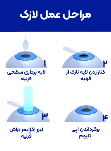 عمل لازک چشم