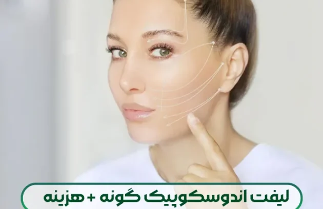 لیفت اندوسکوپیک گونه