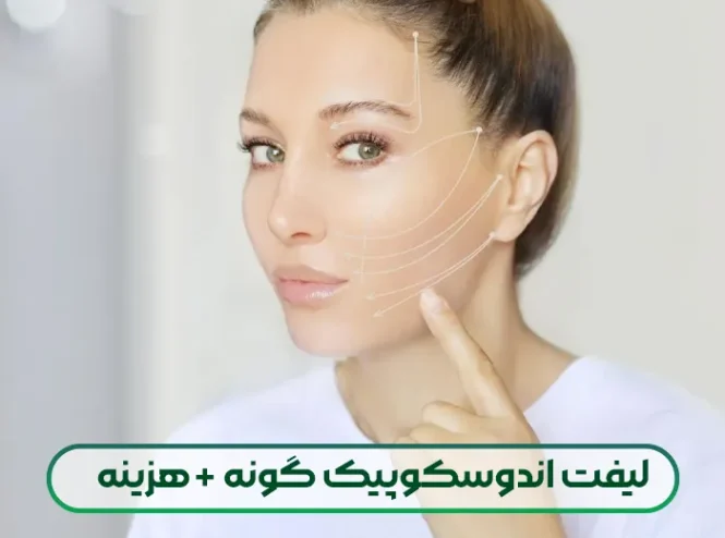 لیفت اندوسکوپیک گونه