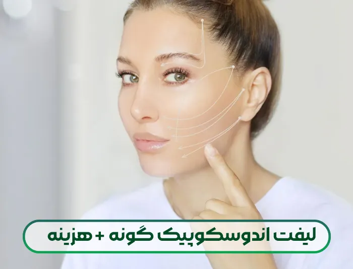 لیفت اندوسکوپیک گونه