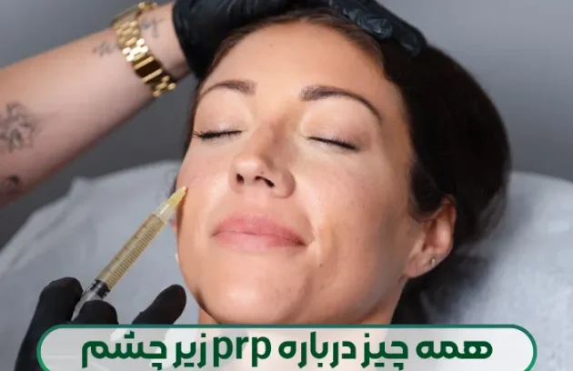 پی آر پی زیر چشم