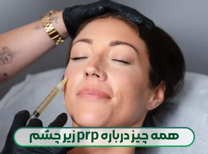 پی آر پی زیر چشم