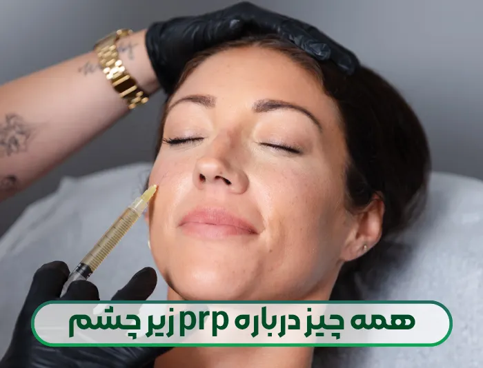 پی آر پی زیر چشم