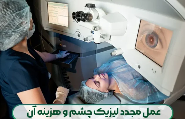 عمل مجدد لیزیک چشم
