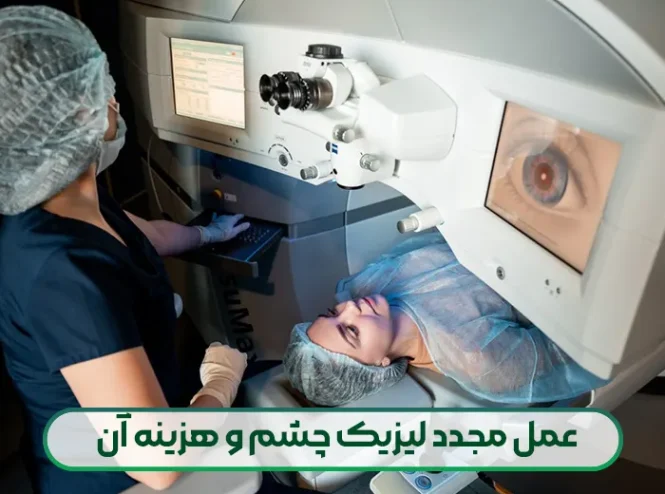 عمل مجدد لیزیک چشم