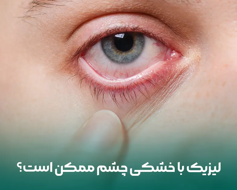 آیا در صورت ابتلا به خشکی چشم می ‌توان عمل لیزیک انجام داد؟