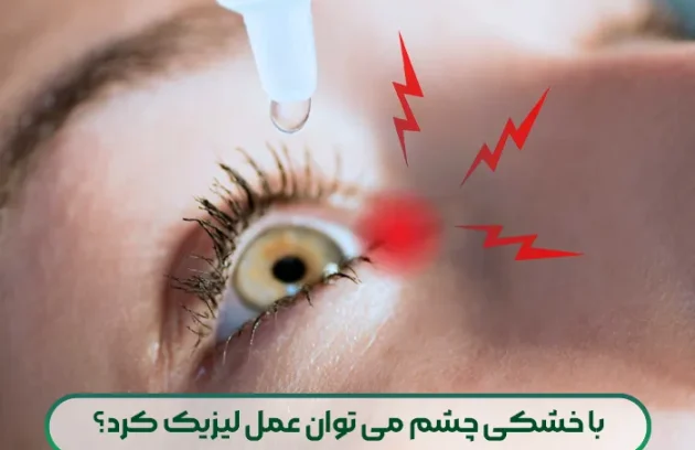 با خشکی چشم می توان عمل لیزیک کرد؟