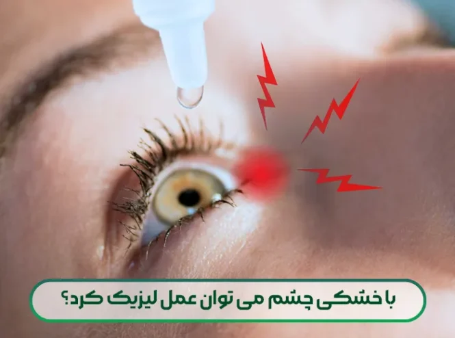 با خشکی چشم می توان عمل لیزیک کرد؟