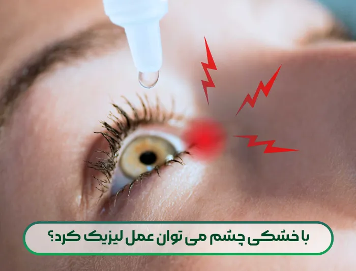 با خشکی چشم می توان عمل لیزیک کرد؟
