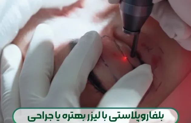 بلفاروپلاستی با لیزر بهتره یا جراحی