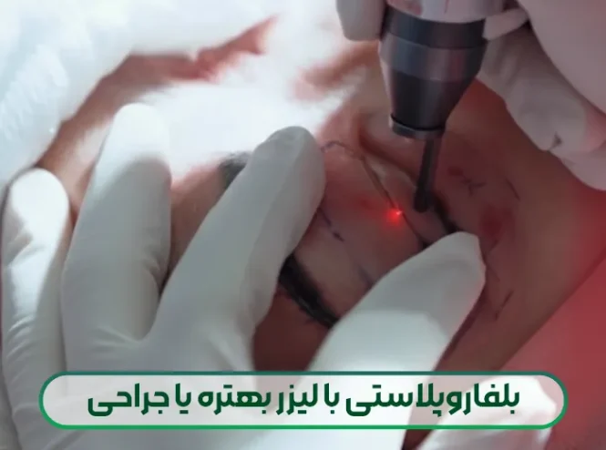 بلفاروپلاستی با لیزر بهتره یا جراحی