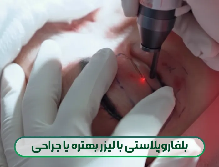 بلفاروپلاستی با لیزر بهتره یا جراحی